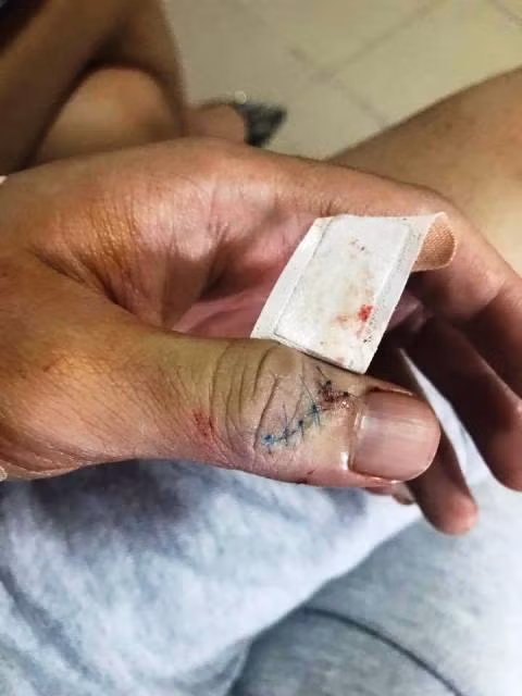 Cảnh báo kính cường lực phòng tắm đột nhiên bị vỡ vụn ảnh 1