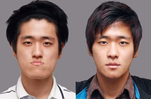 Nam giới Hàn Quốc làm đẹp bằng 'dao kéo' để giống diễn viên, ca sĩ ảnh 4