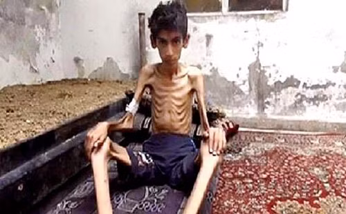 Syria: Đoàn xe viện trợ đến “thành phố chết đói” Madaya ảnh 5