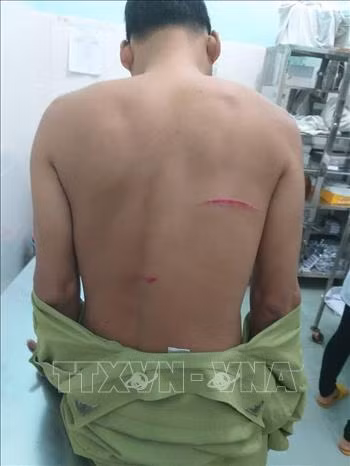 Chú thích ảnh
