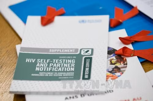 Italy cho phép người dương tính với HIV/AIDS hiến tạng ảnh 1