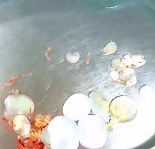 Ăn thịt sống, não người đàn ông nhung nhúc trứng sán dây ảnh 1
