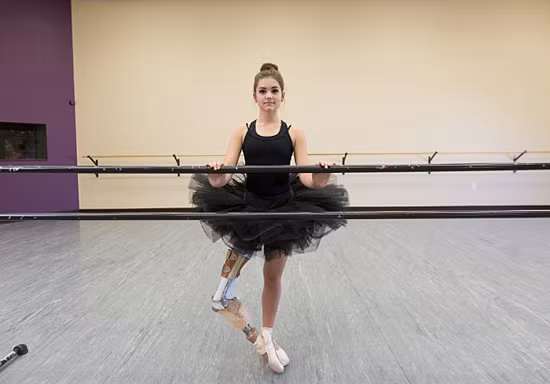 Nghị lực phi thường của vũ công ballet với cẳng chân giả ảnh 3
