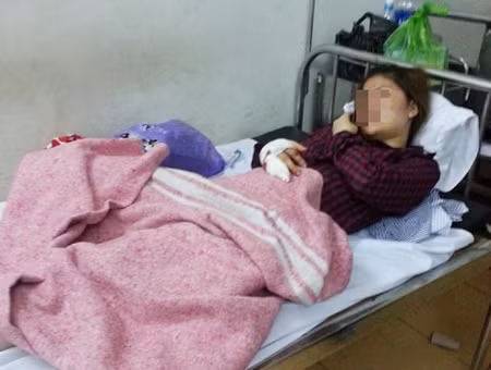 Bưu phẩm phát nổ, nữ kế toán dính hàng chục viên đạn chì ảnh 2