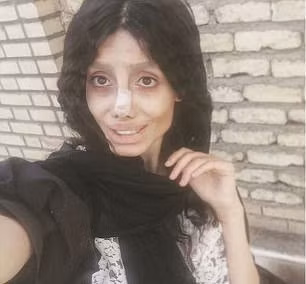 Cô gái trẻ cố bắt chước Angelina Jolie nhưng lại giống 'xác sống' ảnh 6