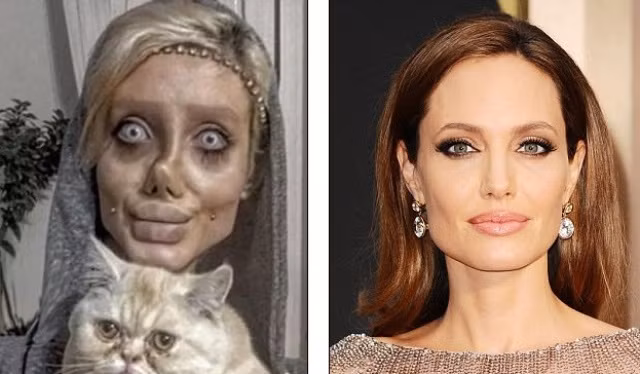 Cô gái trẻ cố bắt chước Angelina Jolie nhưng lại giống 'xác sống' ảnh 1