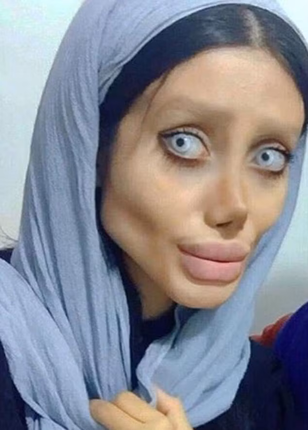 Cô gái trẻ cố bắt chước Angelina Jolie nhưng lại giống 'xác sống' ảnh 2
