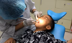 Trên 80% người Việt Nam mắc các bệnh liên quan đến răng, miệng 