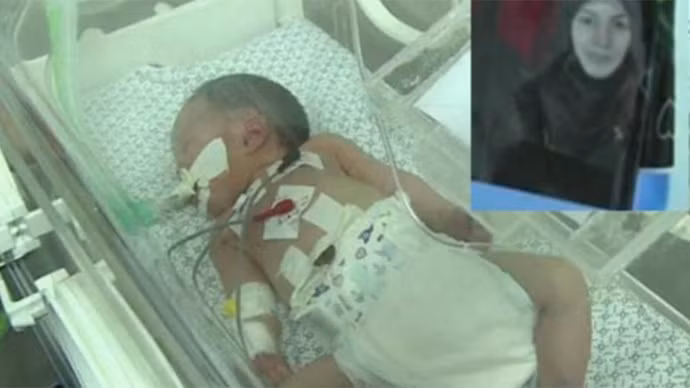 ‘Phép màu’ cũng chết ở Gaza ảnh 2