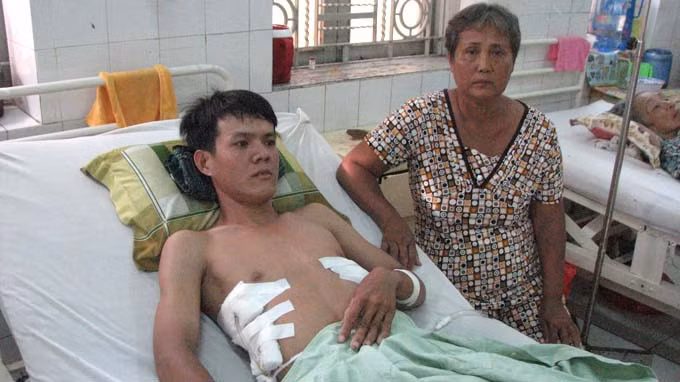 Tràn khí màng phổi trái, bác sĩ mổ... bên phải ảnh 1