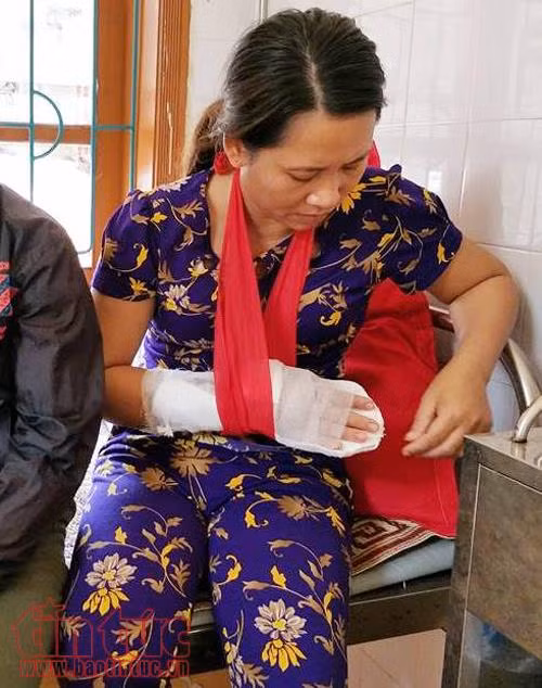 Nữ phó trưởng trạm y tế xã bị nam thanh niên chém trọng thương khi đang trực ảnh 1