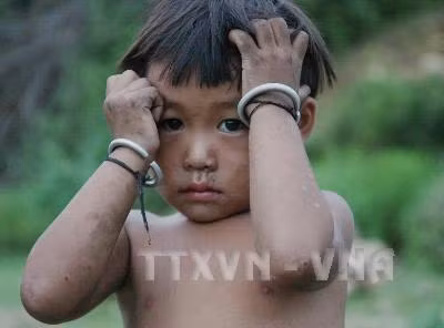 Đôi mắt thơ ngây của em bé Đan Lai... Ảnh tư liệu: Phương Hoa – TTXVN