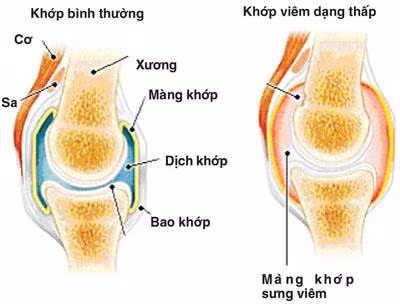 Cá basa bổ huyết, giảm đau nhức ảnh 2