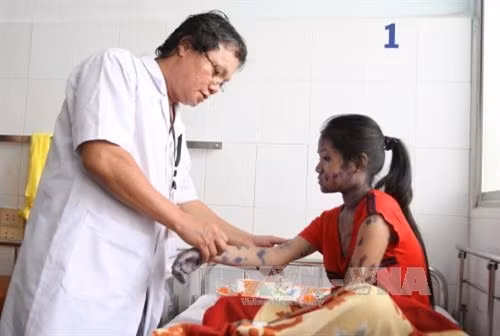 Bác sĩ Trương Hữu Khanh, Trưởng khoa Nhiễm – Thần kinh, Bệnh viện Nhi đồng 1 Thành phố Hồ Chí Minh khám cho bé Nguyễn Thị Mỹ Ngọc, 13 tuổi mắc bệnh thủy đậu đến từ tỉnh An Giang đang điều trị tại khoa. Ảnh: Phương Vy-TTXVN.