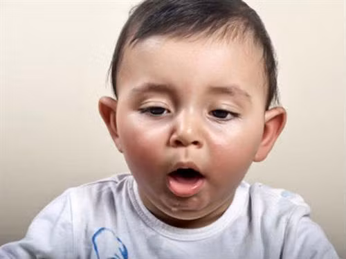 Xử trí tại chỗ dị vật đường thở cho trẻ ảnh 1