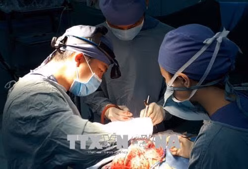 Các bác sỹ Bệnh viện Nhi đồng 2 phẫu thuật tạo hình hộp sọ bị biến dạng cho bệnh nhi. Ảnh: TTXVN phát