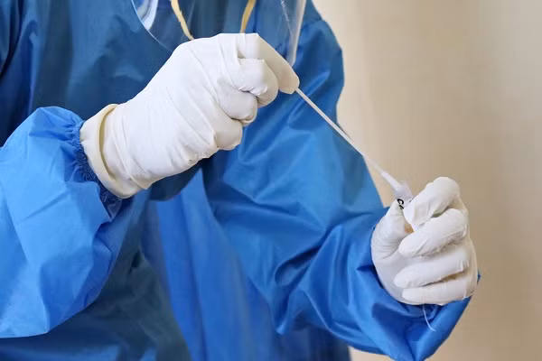 Xét nghiệm dựa trên gene IFI27 giúp chẩn đoán sớm nguy cơ mắc COVID-19 thể nặng ảnh 1
