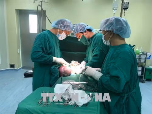 Ca phẫu thuật bóc tách khối u nặng gần 4kg. Ảnh: Quang Thái- TTXVN