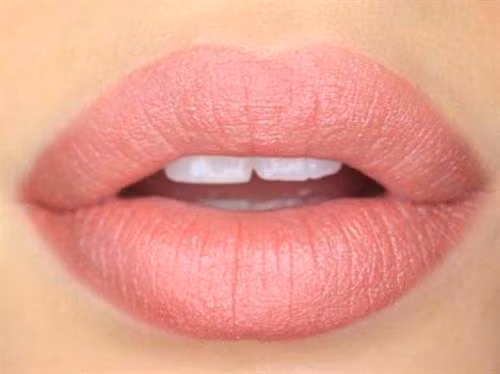 Nhìn màu sắc đôi môi dự đoán bệnh đang mắc ảnh 2