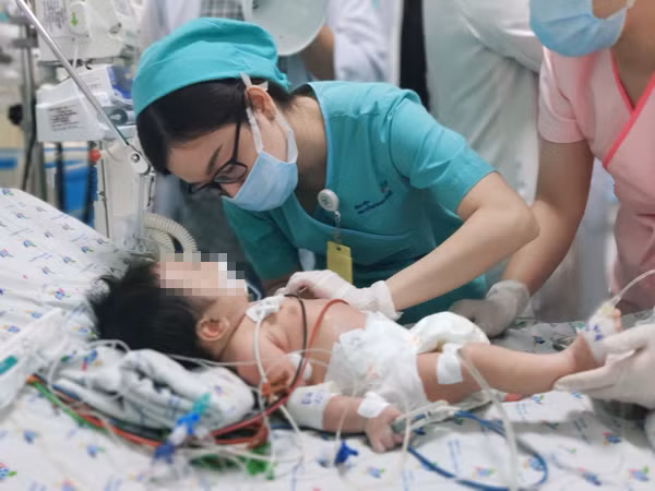 Sặc hạt điều, bé trai hai tuổi suy hô hấp phải thở máy ảnh 1