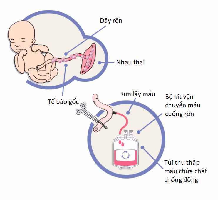 Mở ra cơ hội gửi tế bào gốc máu dây rốn cho người dân nhiều địa phương ảnh 1