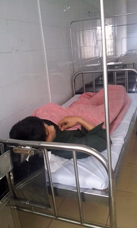 Bị thanh sắt văng vào người, hai công nhân nguy kịch ảnh 1