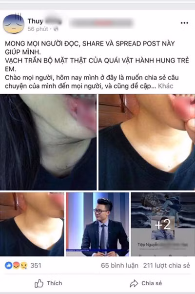 Ninh Bình vào cuộc làm rõ vụ nữ sinh trường Amsterdam tố anh rể bạo hành ảnh 1