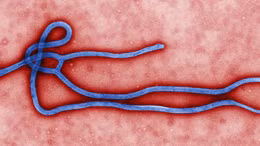 Virus Ebola tấn công cơ thể người thế nào?