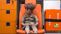 Nhói lòng hình ảnh cậu bé Syria trong xe cứu thương ở Aleppo