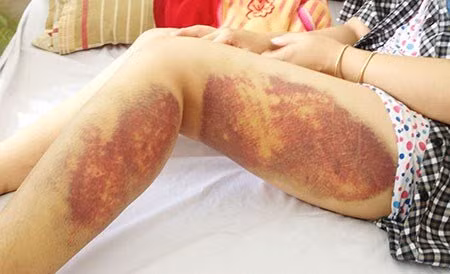 Giáng cấp Trung tá công an đánh nữ công nhân ảnh 1