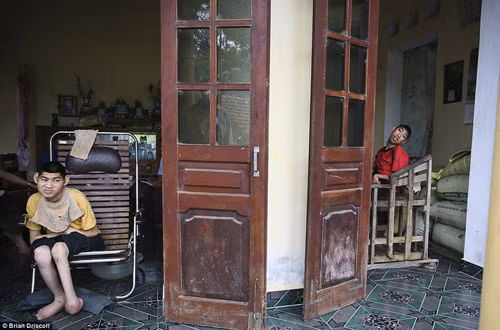 Nạn nhân da cam Việt Nam qua ống kính Mỹ ảnh 1