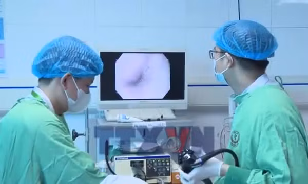 Nội soi gắp chùm chìa khóa trong dạ dày bệnh nhi 30 tháng tuổi