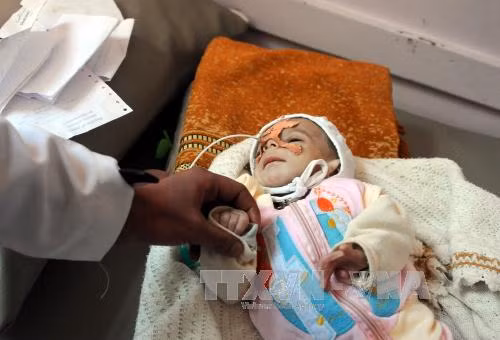 LHQ kêu gọi quyên góp kỷ lục gần 3 tỷ USD cho Yemen ảnh 1