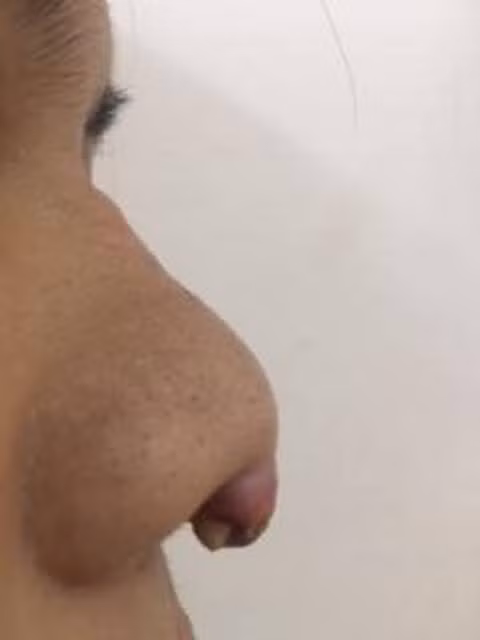  Mũi, mắt, má bị nhiễm trùng nặng vì làm đẹp tại... tiệm làm tóc ảnh 1