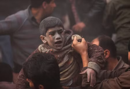 Những nạn nhân bé nhỏ trong nội chiến Syria ảnh 3