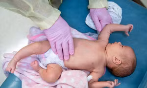 Vaccine thử nghiệm ngừa RSV của Pfizer hiệu quả 82% ngăn diễn biến nặng ở trẻ sơ sinh