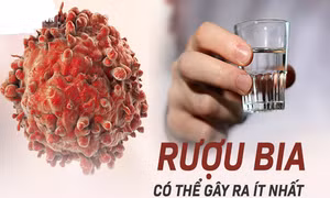 Thói quen uống rượu làm gia tăng nguy cơ mắc bệnh ung thư vú