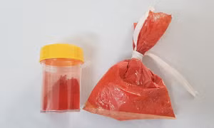 Cảnh báo từ trường hợp ngộ độc nặng do dùng phụ gia không rõ nguồn gốc nấu sốt vang