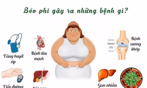 Triển vọng trong việc phát triển thuốc chống béo phì