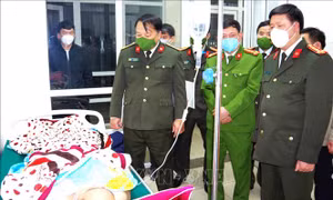 Lãnh đạo Công an tỉnh Hà Giang động viên, thăm hỏi cán bộ, chiến sỹ bị thương đang được điều trị tại bệnh viện. Ảnh: Nguyễn Lân-TTXVN phát