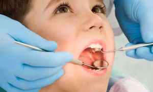 Tai nạn hy hữu trẻ bị hóc khi tự nhổ răng tại nhà