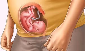 Cảnh báo về hậu quả của nền nhiệt cao đối với sức khỏe thai nhi