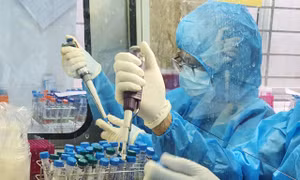 Dịch COVID-19: Không ghi nhận ca mắc mới; 50 trường hợp đã âm tính với SARS –CoV-2