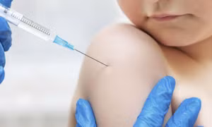 Chuyên gia khuyến cáo người dân nên tiêm vaccine, không chủ quan với bệnh thủy đậu