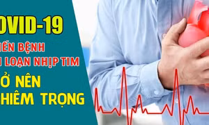 Những điều cần chú ý về sức khỏe tim mạch sau khi mắc COVID-19