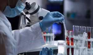 Vai trò quan trọng của kháng thể IgA chống virus SAR-CoV-2