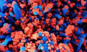 Hình ảnh quét qua kính hiển vi điện tử cho thấy một tế bào (màu xanh) bị virus SARS-COV-2 (màu đỏ) xâm nhập, lấy từ mẫu bệnh phẩm của bệnh nhân COVID-19 tại Viện Nghiên cứu Dị ứng và Bệnh Truyền nhiễm Quốc gia, Mỹ ngày 28/7/2020. Ảnh: AFP/TTXVN