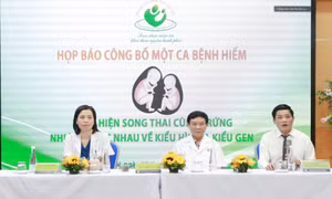 Giám đốc Bệnh viện Phụ sản Hà Nội công bố ca bệnh hiếm, song thai cùng trứng nhưng lại khác nhau 100%.. Ảnh: laodongthudo.vn