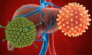 Gia tăng ca nhiễm Adenovirus: dấu hiệu nhận biết và cách phòng bệnh