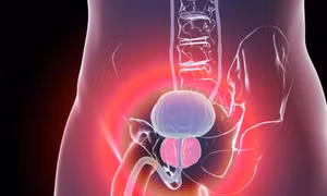 Nga phát triển liệu pháp phóng xạ trị ung thư tuyến tiền liệt